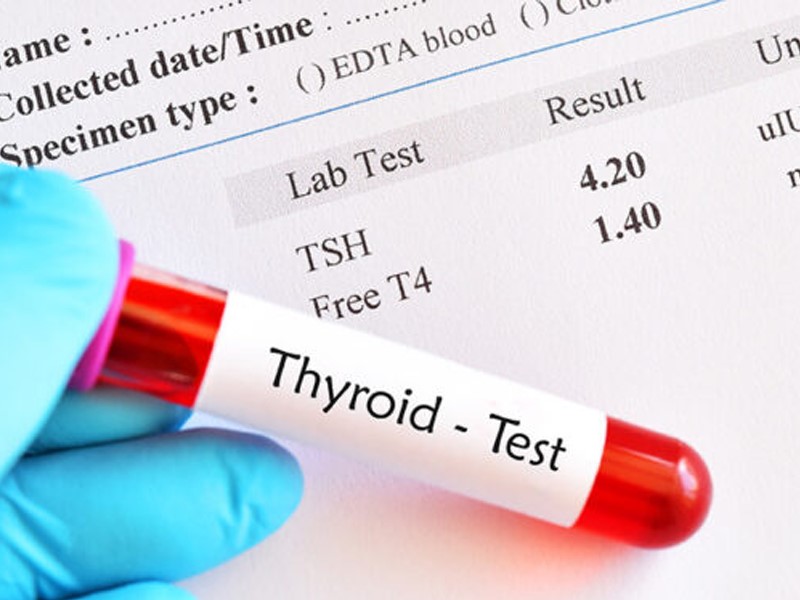 آزمایش تیروئید